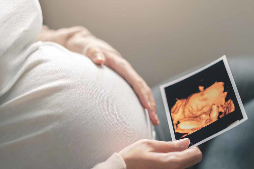Nahaufnahme einer Frau mit Babybauch die ihr Ultraschallbabybild anschaut.